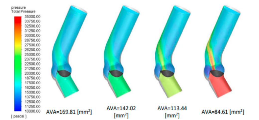 CFD results of a heart valve 